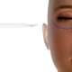 Illustration for article titled Find Out A Lot More Regarding Cosmetic Surgery Now In Order To See If Its Right For Youem/em